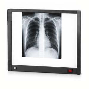 X Ray Viewer